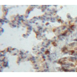 A Disintegrin And Metalloproteinase With Thrombospondin 8 (ADAMTS8) Antibody