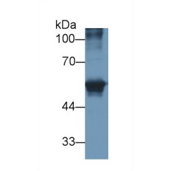 Carcinoembryonic Antigen Related Cell Adhesion Molecule 1 (CEACAM1) Antibody