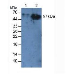 Carcinoembryonic Antigen Related Cell Adhesion Molecule 1 (CEACAM1) Antibody