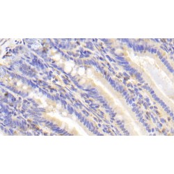 Carcinoembryonic Antigen Related Cell Adhesion Molecule 1 (CEACAM1) Antibody