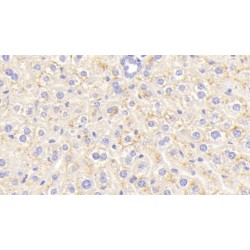 Carcinoembryonic Antigen Related Cell Adhesion Molecule 1 (CEACAM1) Antibody