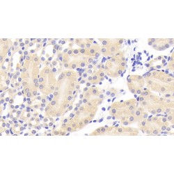 Carcinoembryonic Antigen Related Cell Adhesion Molecule 1 (CEACAM1) Antibody