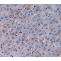 Carcinoembryonic Antigen Related Cell Adhesion Molecule 3 (CEACAM3) Antibody