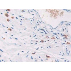 Carcinoembryonic Antigen Related Cell Adhesion Molecule 7 (CEACAM7) Antibody