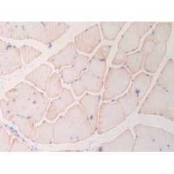 Myosin Light Chain 6B, Alkali, Smooth Muscle And Non Muscle (MYL6B) Antibody