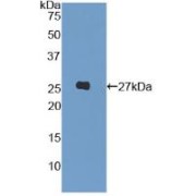 Western blot analysis of recombinant Human LILRA3.