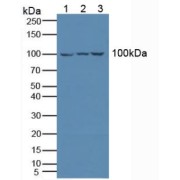 Western blot analysis of (1) Human Jurkat Cells, (2) Human K562 Cells and (3) Human Raji Cells.