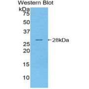 abx104722