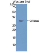 Western blot analysis of the recombinant protein.