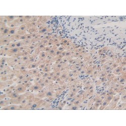 MAP Kinase-Activated Protein Kinase 2 (MAPKAPK2) Antibody