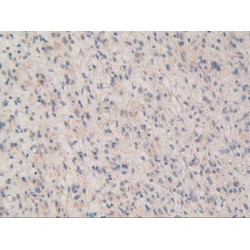 MAP Kinase-Activated Protein Kinase 2 (MAPKAPK2) Antibody