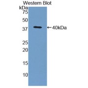 Western blot analysis of the recombinant protein.