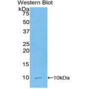 Western blot analysis of the recombinant protein.