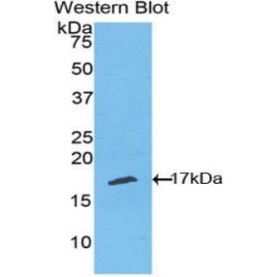 Tumor Necrosis Factor Receptor Superfamily, Member 19 Like Protein (TNFRSF19L) Antibody