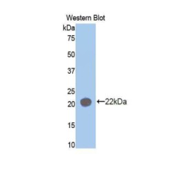 Aminoacyl tRNA Synthetase Complex Interacting Multifunctional Protein 1 (AIMP1) Antibody