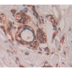 Aminoacyl tRNA Synthetase Complex Interacting Multifunctional Protein 1 (AIMP1) Antibody