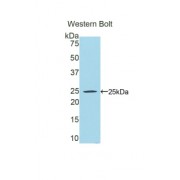 Western blot analysis of recombinant Mouse PPARgC1a Protein.