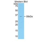 Western blot analysis of recombinant Rat PPARgC1a Protein.