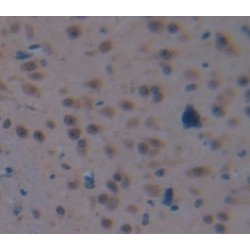Protein L-Myc (MYCL) Antibody