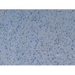 KH Domain Containing, RNA Binding, Signal Transduction Associated Protein 1 (KHDRBS1) Antibody