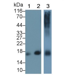 Myoglobin (MB) Antibody