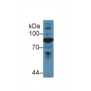 Western blot analysis of Chicken Serum, using Chicken C4 Antibody (5 µg/ml) and HRP-conjugated Goat Anti-Rabbit antibody (<a href="https://www.abbexa.com/index.php?route=product/search&amp;search=abx400043" target="_blank">abx400043</a>, 0.2 µg/ml).