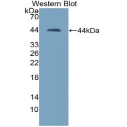 S100 Calcium Binding Protein A11 (S100A11) Antibody
