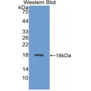 Western blot analysis of the recombinant protein.