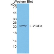 Western blot analysis of the Cow recombinant HP protein.