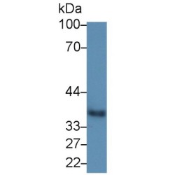 Haptoglobin Precursor / Zonulin (HP) Antibody