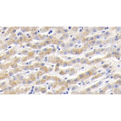 Haptoglobin Precursor / Zonulin (HP) Antibody