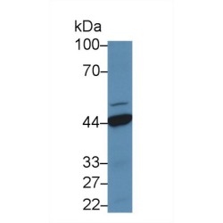 Haptoglobin Precursor / Zonulin (HP) Antibody