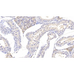 Interleukin 1 Beta (IL1b) Antibody