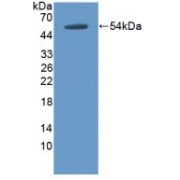 abx104895