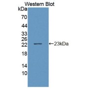 abx104904