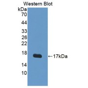 abx104918
