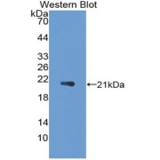 abx104933