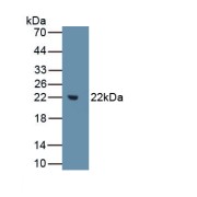 Western blot analysis of recombinant Human MMP3.