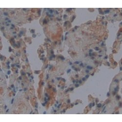 Stromelysin-1 (MMP3) Antibody