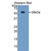 Western blot analysis of the recombinant protein.