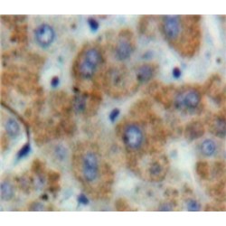 Tissue Factor Pathway Inhibitor (TFPI) Antibody