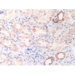 Heat Shock 60 kDa Protein 1, Chaperonin / HSP60 (HSPD1) Antibody