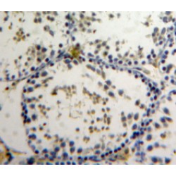 Nuclear Matrix Protein 4 (NMP4) Antibody