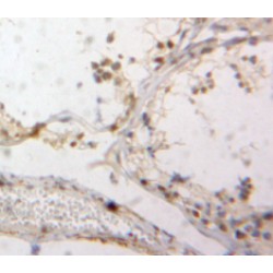 Down Regulator Of Transcription 1, TBP Binding (DR1) Antibody
