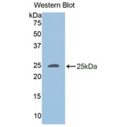 Western blot analysis of recombinant human ADRP.