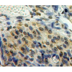 E3 SUMO-Protein Ligase EGR2 (EGR2) Antibody