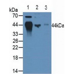 HLA class I histocompatibility antigen, B alpha chain (HLA-B) Antibody