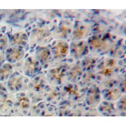 Sirtuin 5 (SIRT5) Antibody