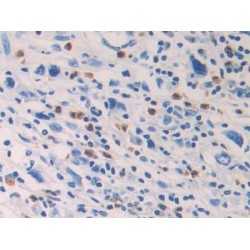 Hematopoietic Prostaglandin D Synthase (HPGDS) Antibody
