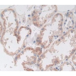 Deoxyribonuclease II (DNASEII) Antibody